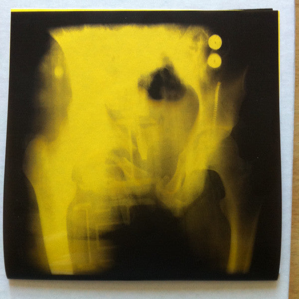Cracked Pelvis E.P.